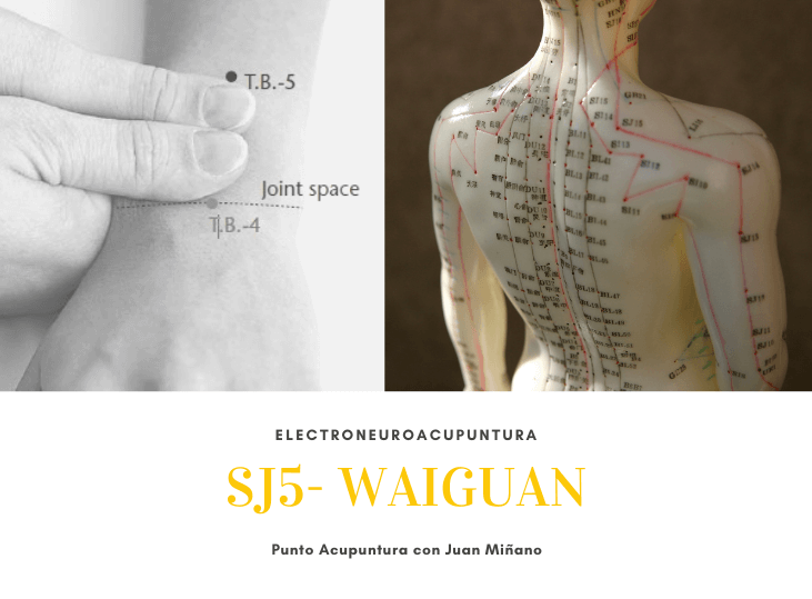 sj5-waiguan-electroneuroacupuntura